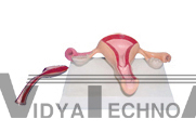 The model of normal uterus